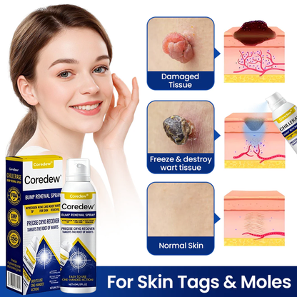 Coredew® ChillErase Bump Renewal Spray